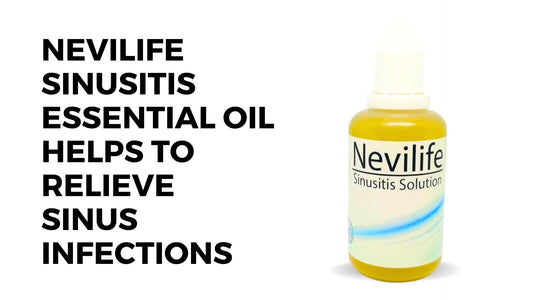 Herbal Essential Oil for Sinusitis Remedy