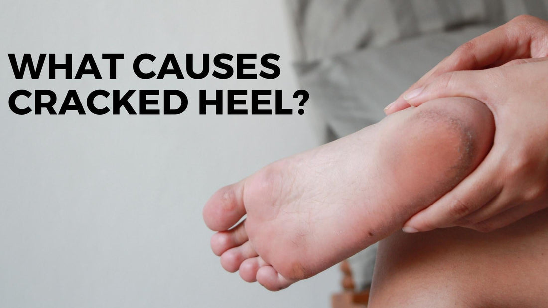 What causes cracked heel