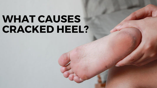 What causes cracked heel