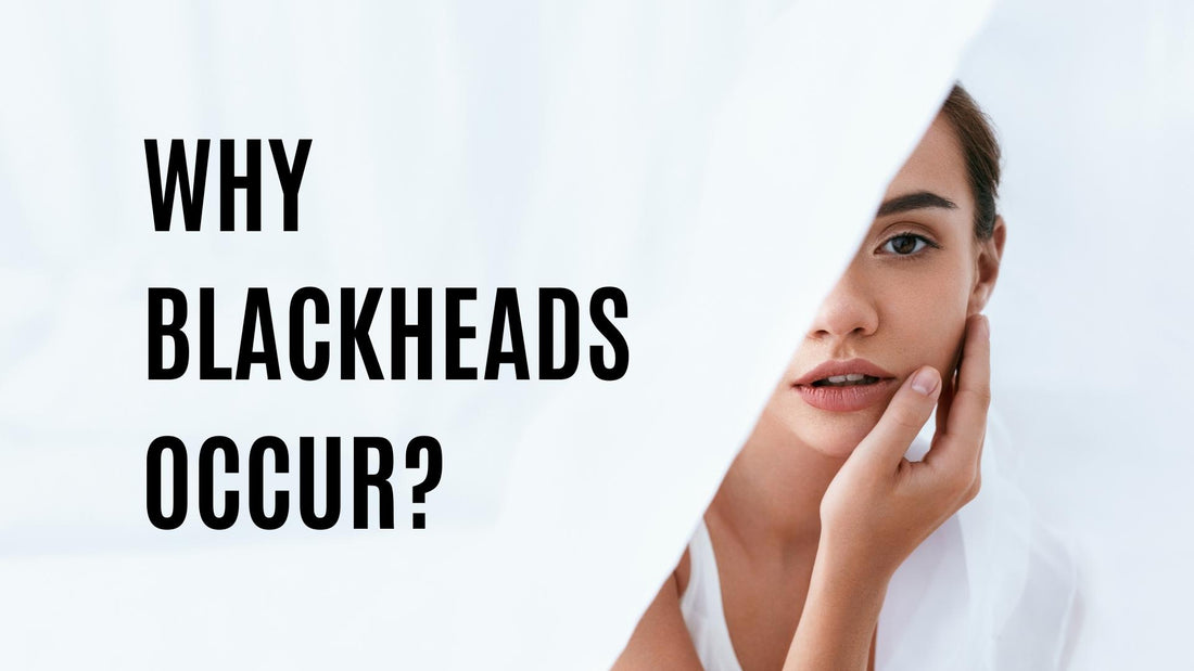 Why Blackheads Occur?