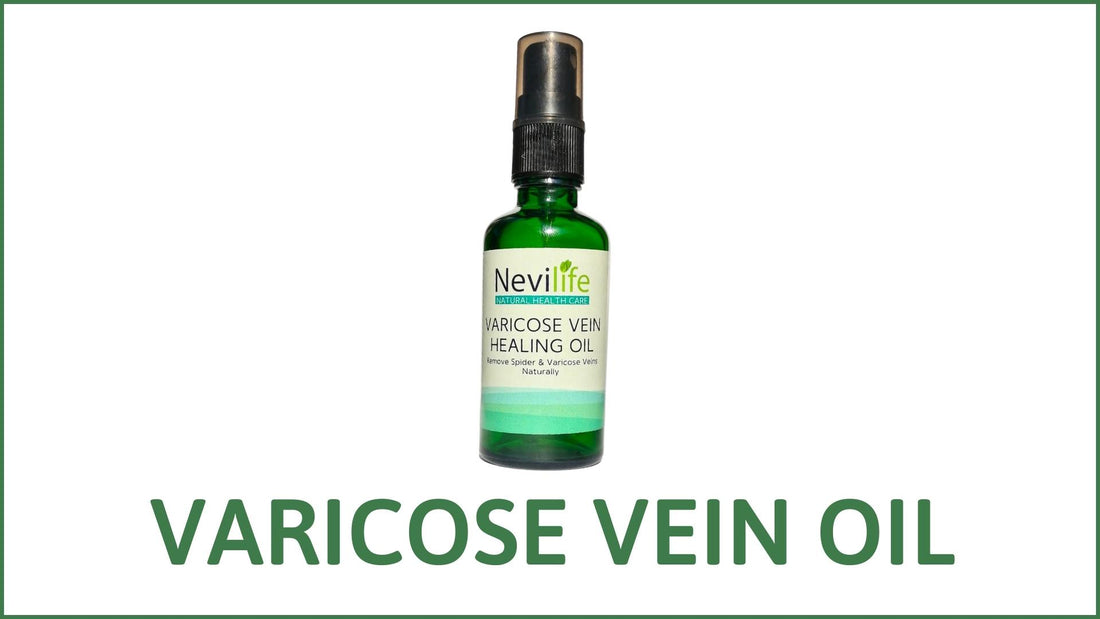 Varicose Vein Healing Oil