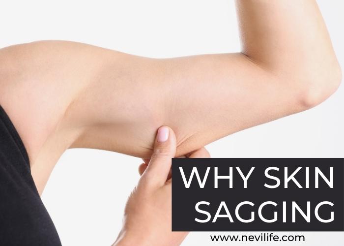 Why Skin Sagging Occur & How Prevent it?