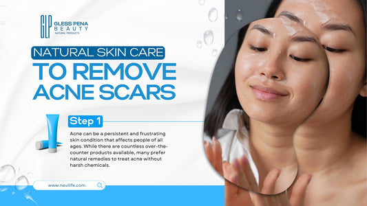 Natural Skin Care to Remove Acne: Effective Remedies and Tips