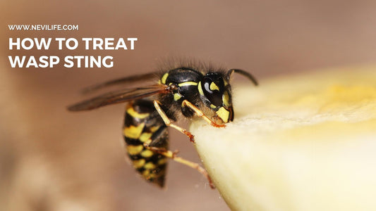 How to Treat Wasp Sting?