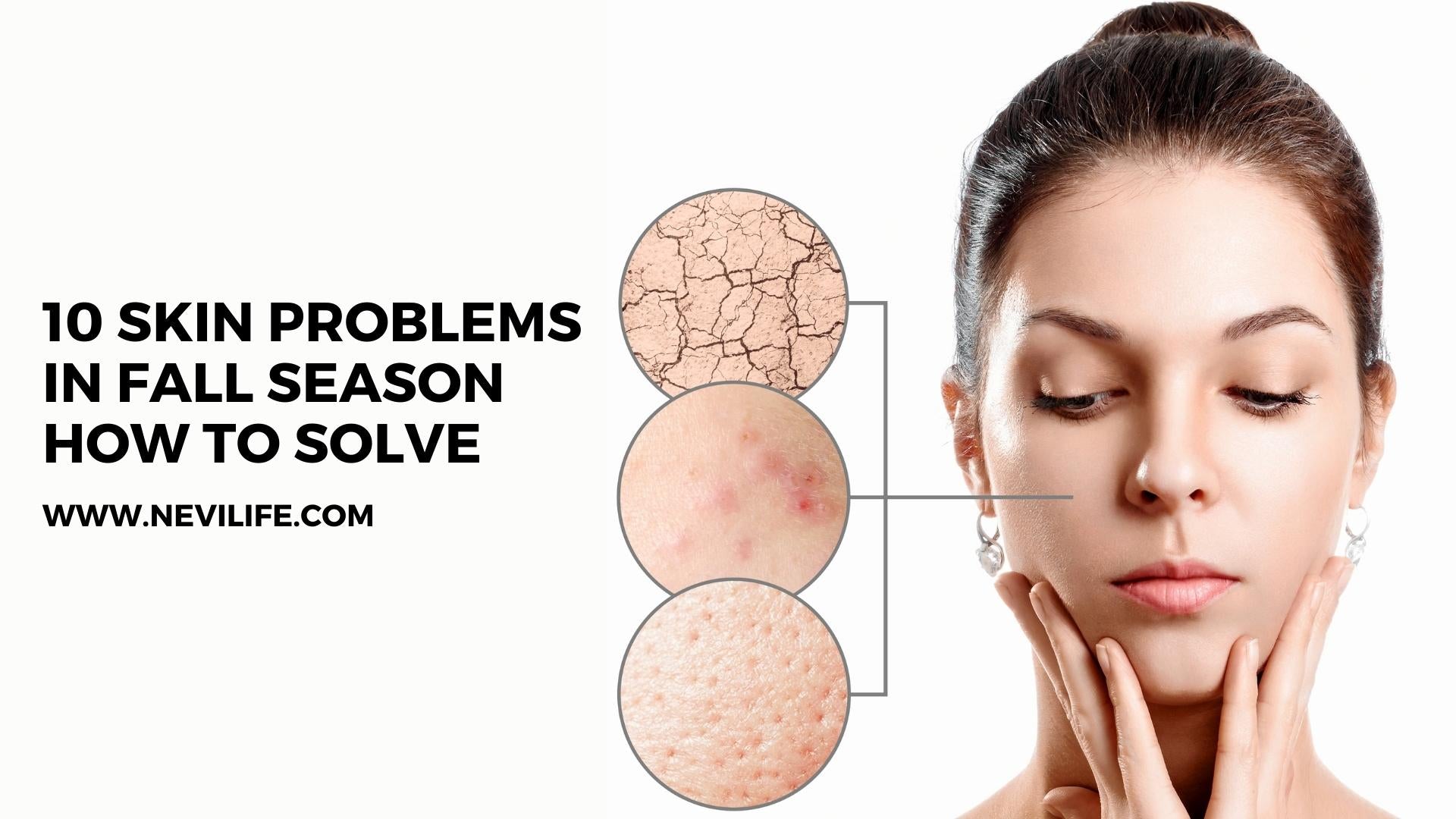 Fall Skin Problem 10 Skin Problems in Fall Season & How to Solve – nevilife