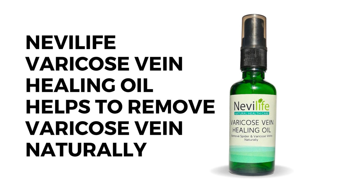 Nevilife Varicose Vein Healing Oil Benefits