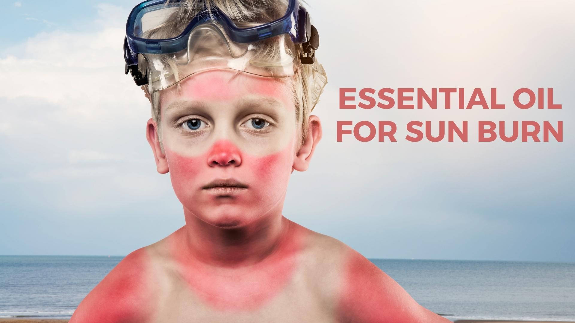 Essential Oils Good for Sunburn – nevilife