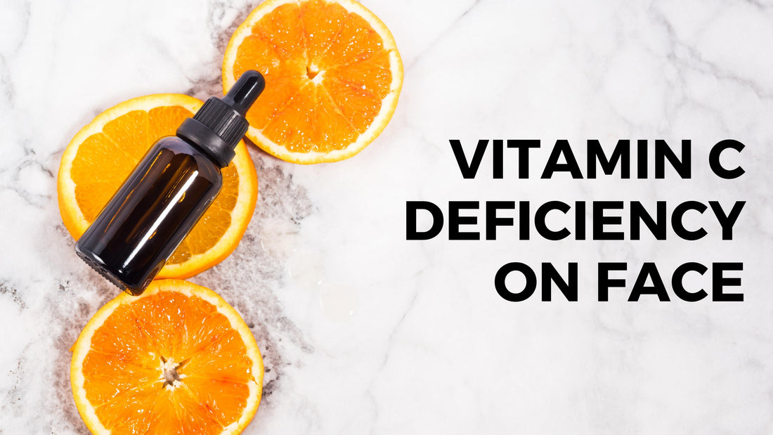 Vitamin C Deficiency on Face