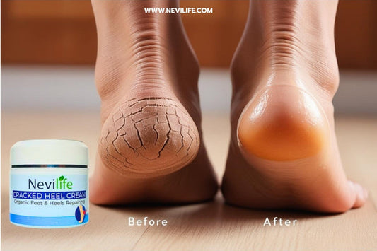 carrot oil benefits for cracked heel
