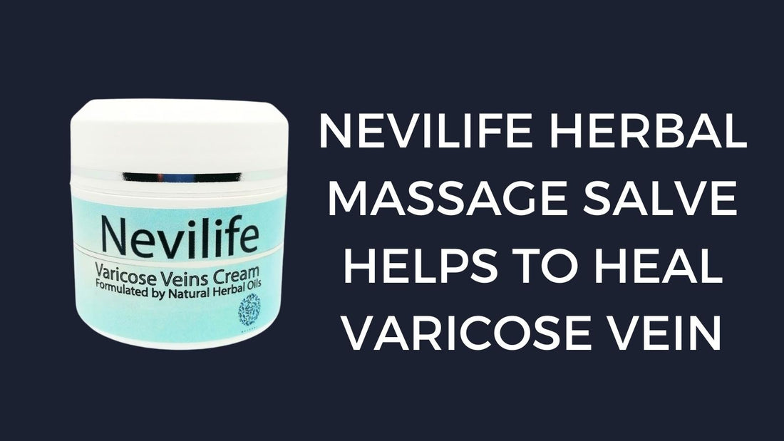 Herbal Massage Salve to Heal Varicose Vein