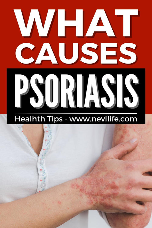 What Causes Psoriasis