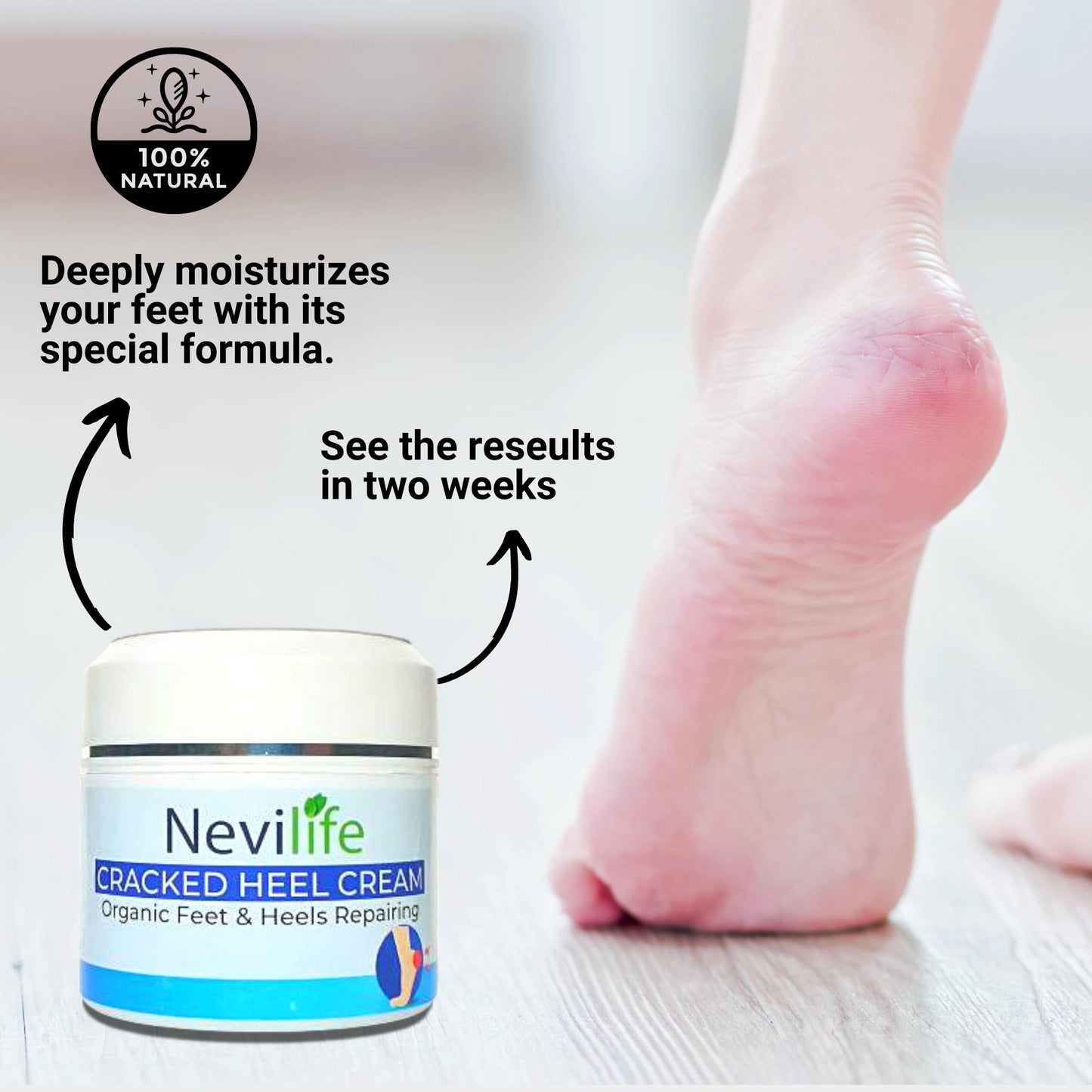 Herbal Cracked Heel Cream, Feet Repair Cream, Cracked Foot Salve, Natural Moisturizer for Dry Feet, Oranic Foot Balm, Cracked Feet Healing
